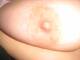 Seno1